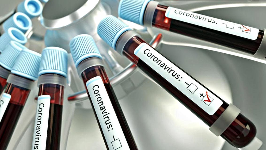 Toscana, plasma iperimmune dei guariti contro Coronavirus