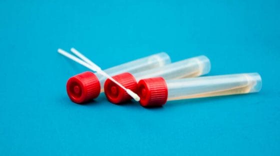 Coronavirus: Lancet,test sierologici vanno ripetuti nel tempo 
