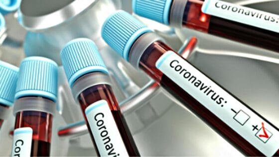 Coronavirus in Toscana, oggi 599 nuovi casi. Nessun decesso