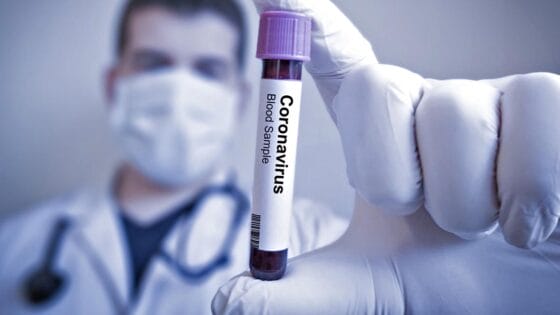 Coronavirus in Toscana, 273 nuovi casi, 2 decessi