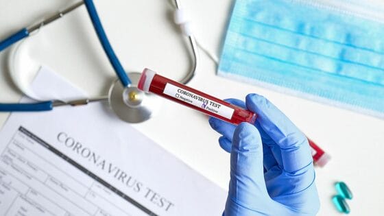Coronavirus in Toscana, 341 nuovi casi, 4 decessi