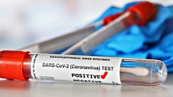 Coronavirus in Toscana, 343 nuovi casi, 2 decessi