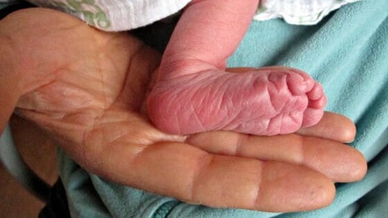 Doppio cognome per i neonati, a Firenze indicazione operative in punti nascita